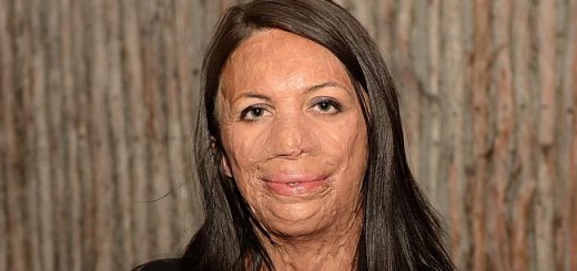 turia pitt