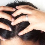 6 Easy Wasy To Get Rid Of Dry Scalp And Dry Hair