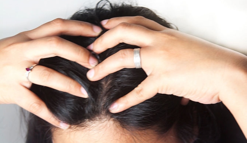 woman massaging her scalp