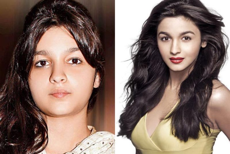alia bhatt before and after weight loss