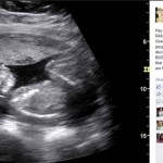 This Woman’s Facebook Fertility Rant Is The Best Thing You Will Read Today!