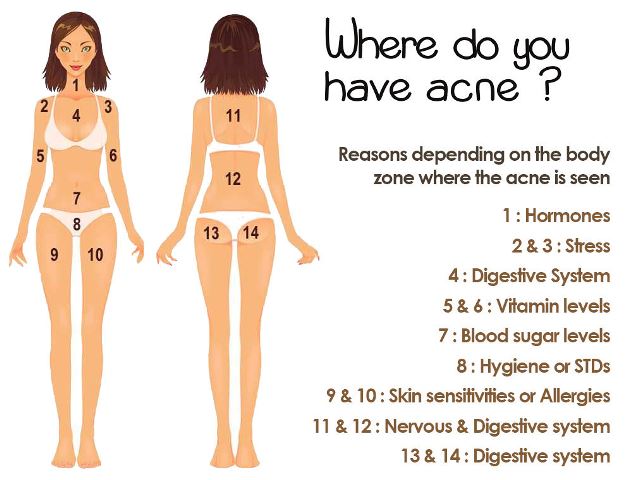 acne zones_New_Love_Times
