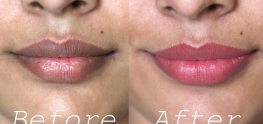 home remedies for dark lips_New_Love_Times