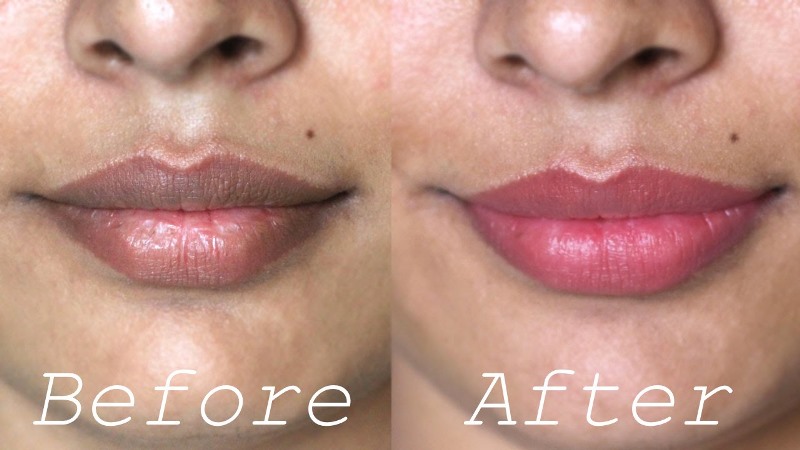 home remedies for dark lips_New_Love_Times