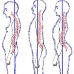 #StraightenUp: 5 Postural Deviations And How You Can Fix Them