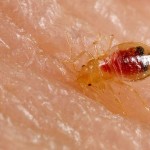 15 Superbly Effective Home Remedies For Bed Bug Bites