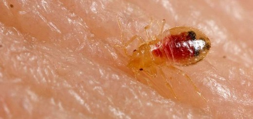 home remedies for bed bug bites_New_Love_Times