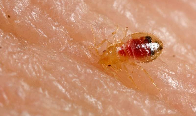 home remedies for bed bug bites_New_Love_Times