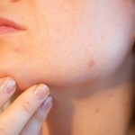 12 Of The Best Home Remedies For Brown Spots On Your Skin