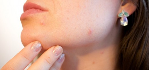 home remedies for brown spots on face_New_Love_Times