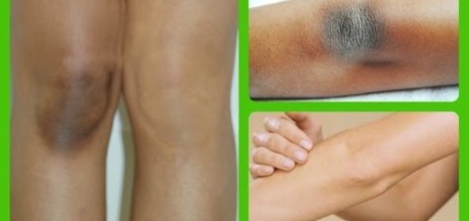 home remedies for dark elbows_New_Love_Times