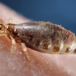 The Most Effective Home Remedies For Body Lice