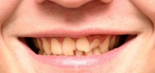 cracked tooth home remedies_New_Love_Times