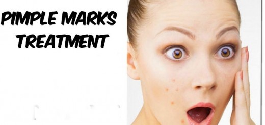 home remedies for pimple marks_New_Love_Times