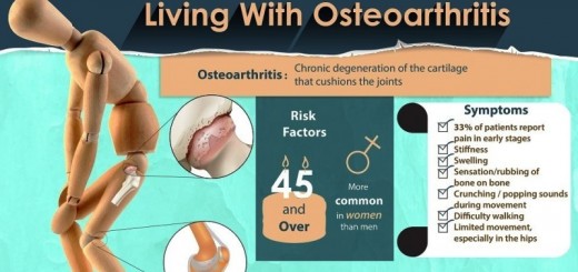 Home remedies for osteoarthritis_New_Love_Times