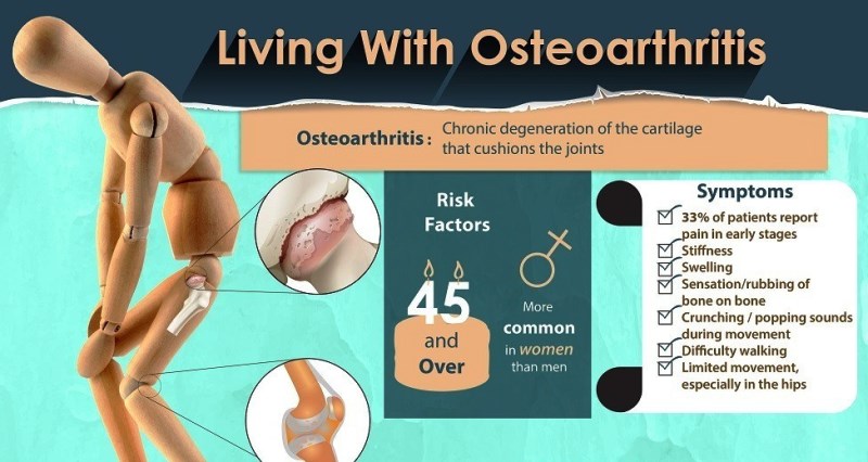 Home remedies for osteoarthritis_New_Love_Times