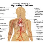 Cure Hypothyroidism Naturally With These Natural Home Remedies