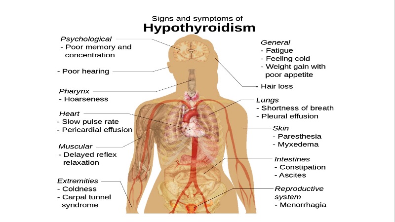 home remedies for hypothyroidism_New_Love_Times