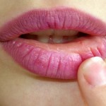 10 Easy Yet Superbly Effective Home Remedies For Pink, Kissable Lips