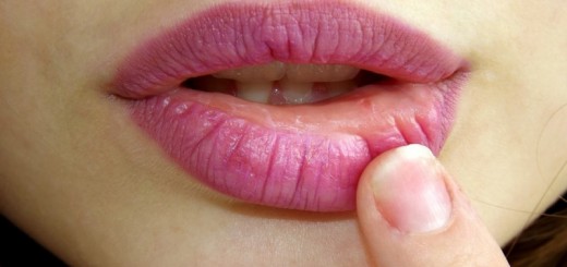home remedies for pink lips_New_Love_Times