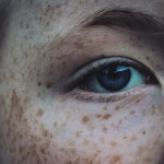 12 Excellent Home Remedies To Get Rid Of Freckles Successfully