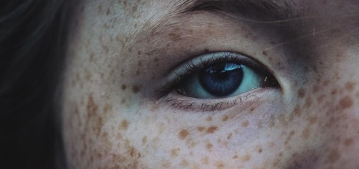 home remedies for freckles_New_Love_Times