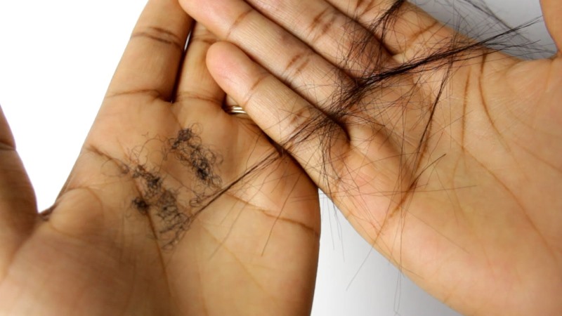 11 Superbly Effective Home Remedies For Hair Breakage