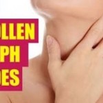 All You Need To Know About Treating Swollen Lymph Nodes With Home Remedies