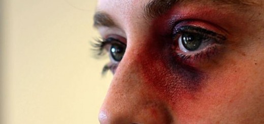 home remedies for black eyes_new_love_times