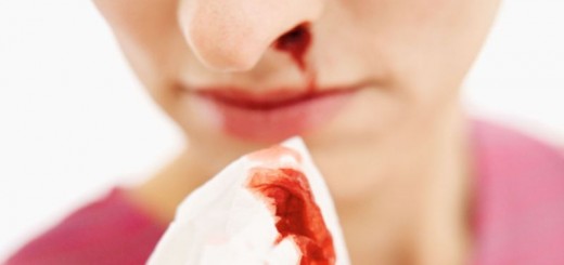 home remedies for nosebleeds_new_love_times