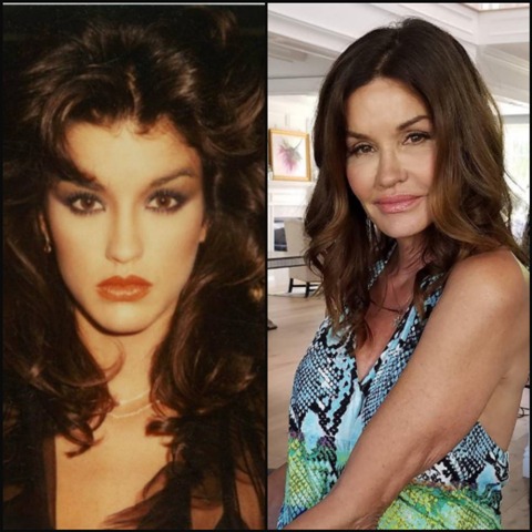 celebrity plastic surgery gone wrong_new_love_times