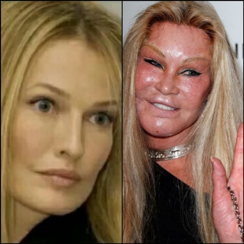 celebrity plastic surgery gone wrong_new_love_times