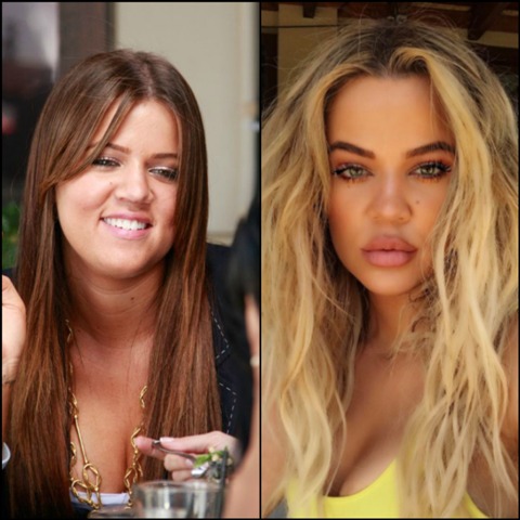 celebrity plastic surgery gone wrong_new_love_times