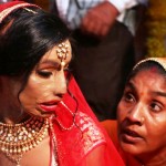 Acid Attack Victor, Lalita Bansi, Marries The Love Of Her Life, Reinstating Our Faith In Love