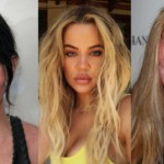 15 Cringe-Worthy Cases Of Celebrity Plastic Surgery Gone Wrong