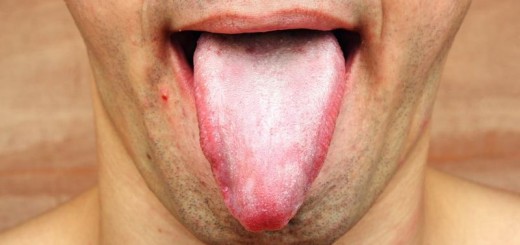 home remedies for white tongue_new_love_times