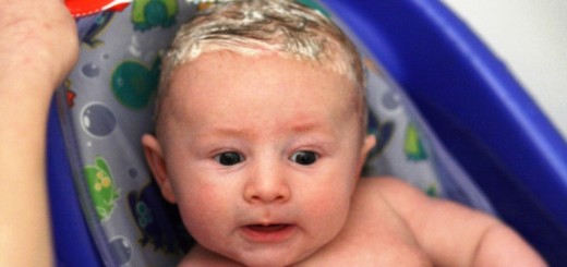 Home remedies for cradle cap_New_Love_Times