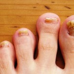 Toes Usually Get Very Little Care! It’s Time We Change That!