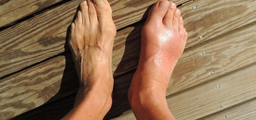 home remedies for gout pain_new_love_times