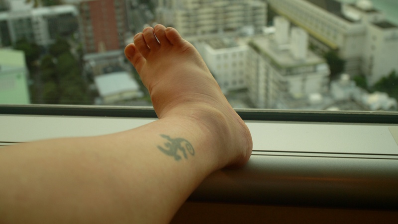 home remedies for sprained ankle_new_love_Times