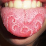 Dirty Tongue Can Be A Major Turn Off! Treat It At Home